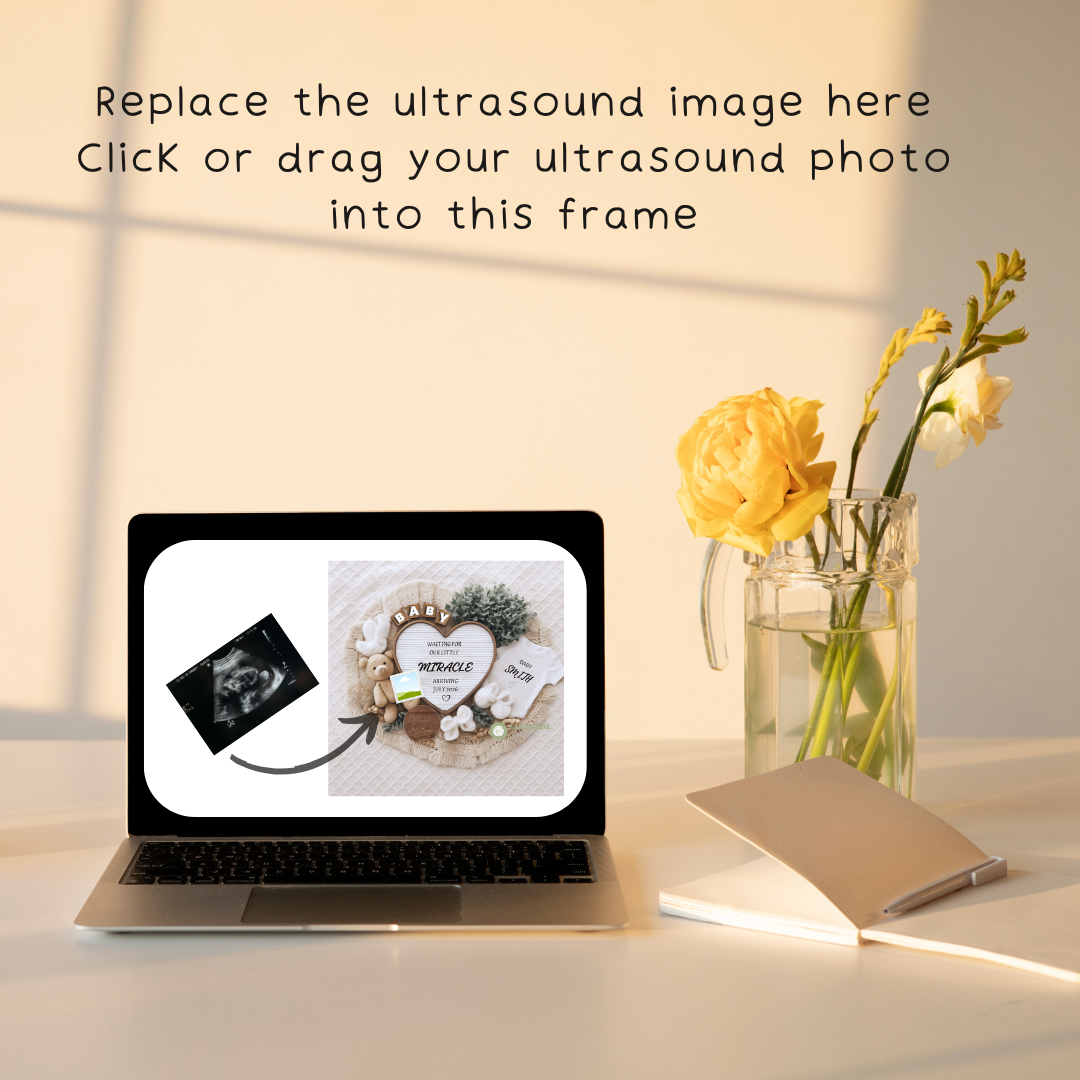 Editable Digital Pregnancy Announcement Template – Modern & Minimal Canva Design